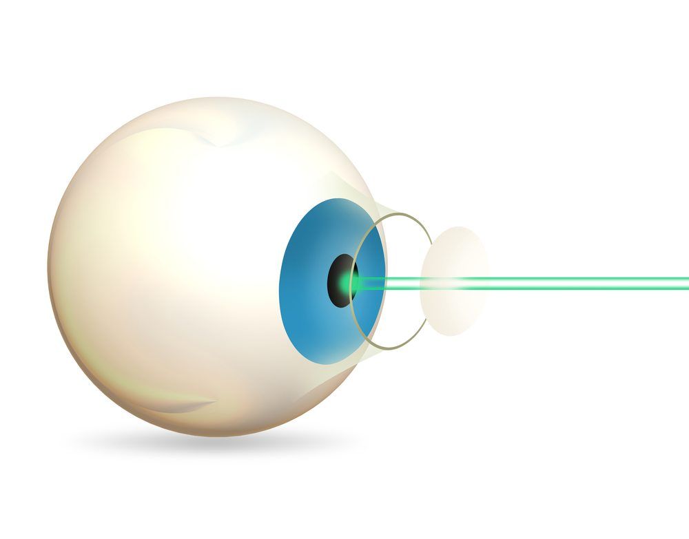 Lasers in Ophthalmology » Columbus TX Ophthalmologist Columbus Eye